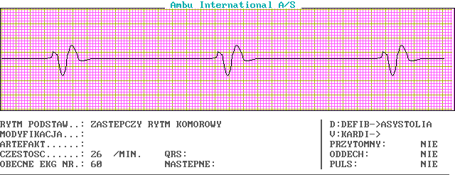 EKG wykresy z łyżek, Pierwsza Pomoc - c60-0.png